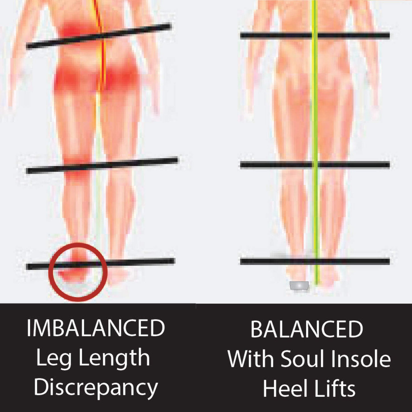 Heel Lifts / Gel Heel Cushions